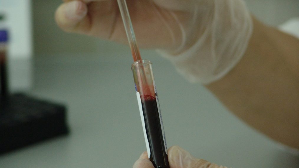 immunologie