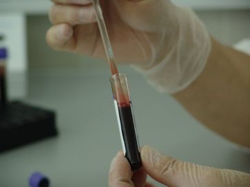 L’immunologie : comprendre comment ton corps se protège ! 